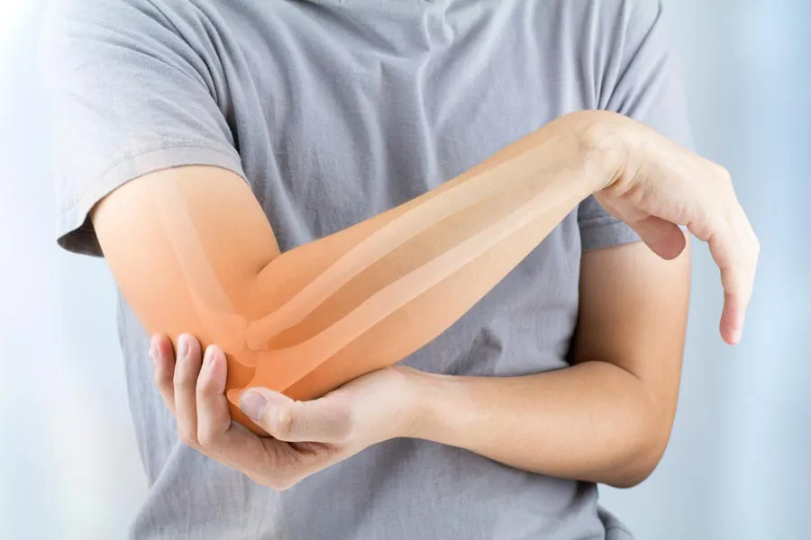 Osteoporosis-Doctor A close-up of a woman holding her elbow with an illustration of the bones and joint experiencing pain from osteoporosis. Get osteoporosis treatment from Kane Lai, MD in Dallas-Fort Worth Metroplex.